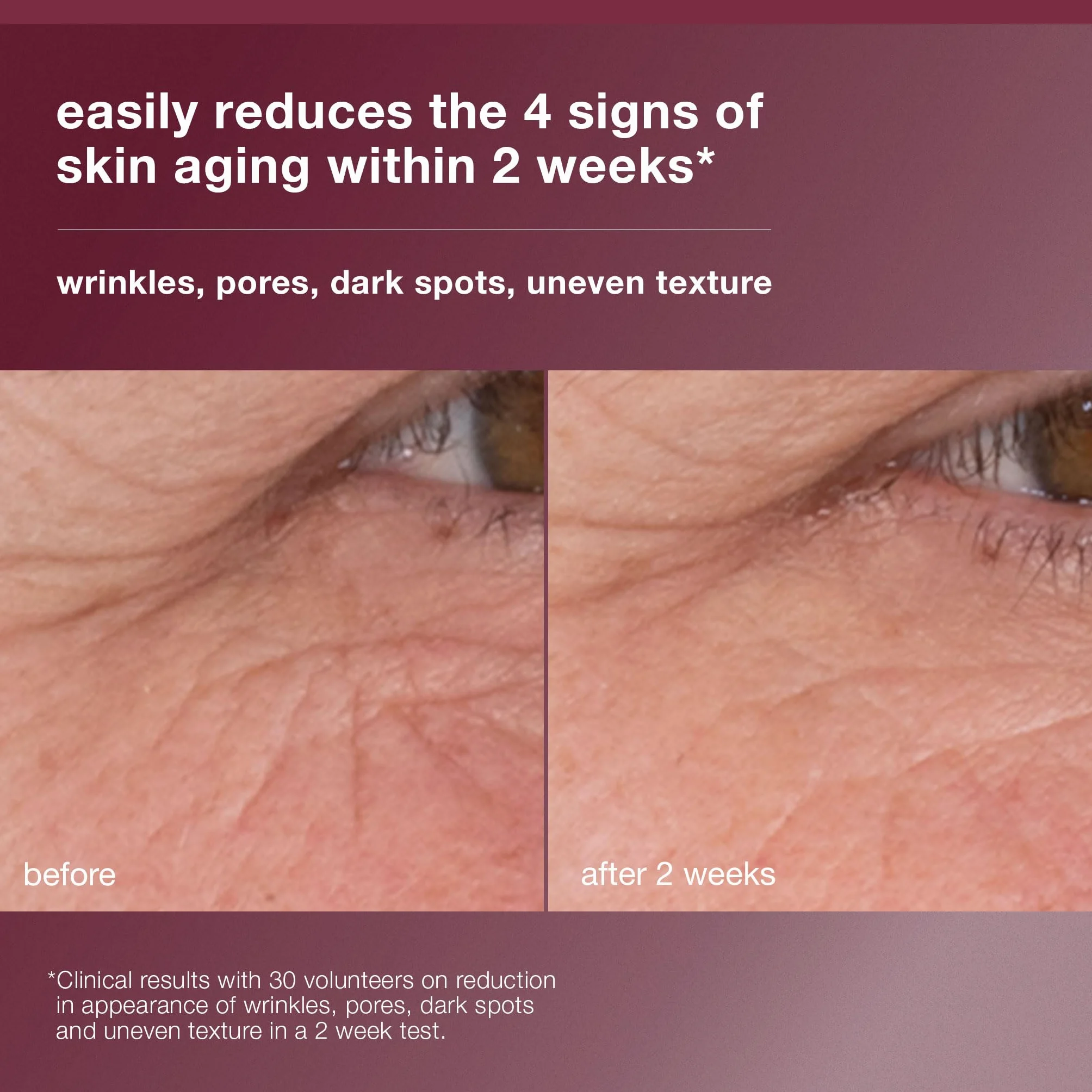 Dermalogica Dynamic Skin Retinol Serum 3,5% - Sérum concentré anti-rides et taches