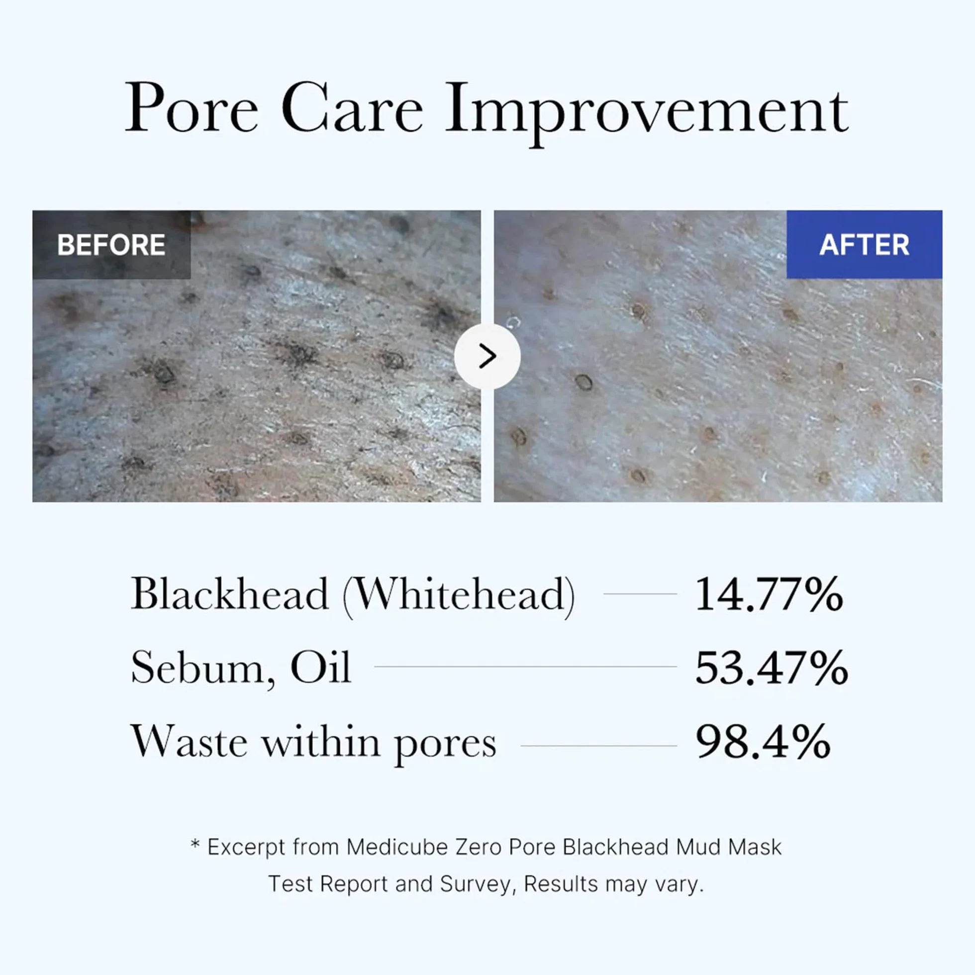 Medicube Zero Pore Blackhead Mud Mask 3.52 oz AHA BHA PHA