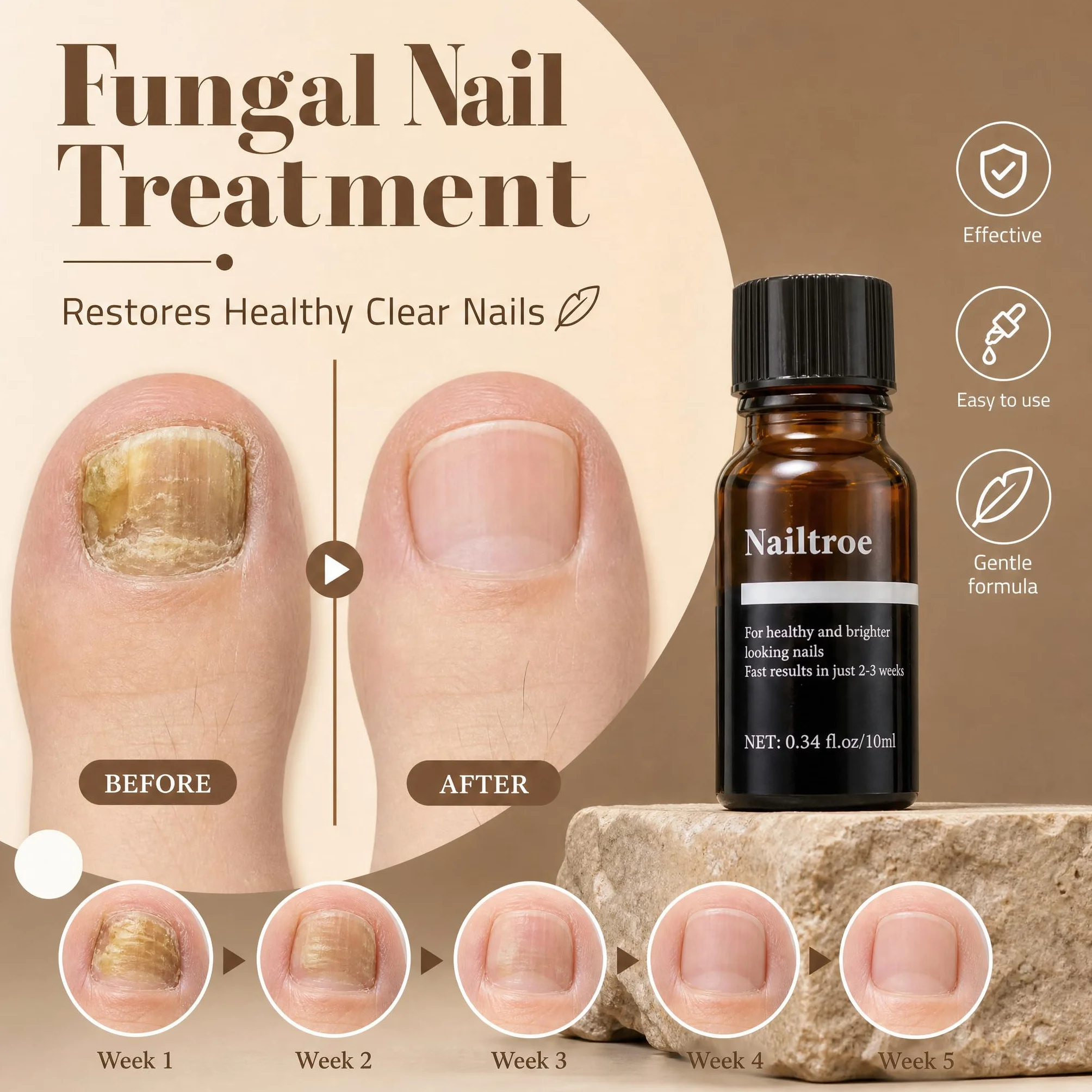 Mycose Ongles des Pieds - Traitement Antifongique Puissant, Soin Réparateur pour Ongles Abîmés, Nailtroe Formule Purifiante et Protectrice sans Colorants, 10ml