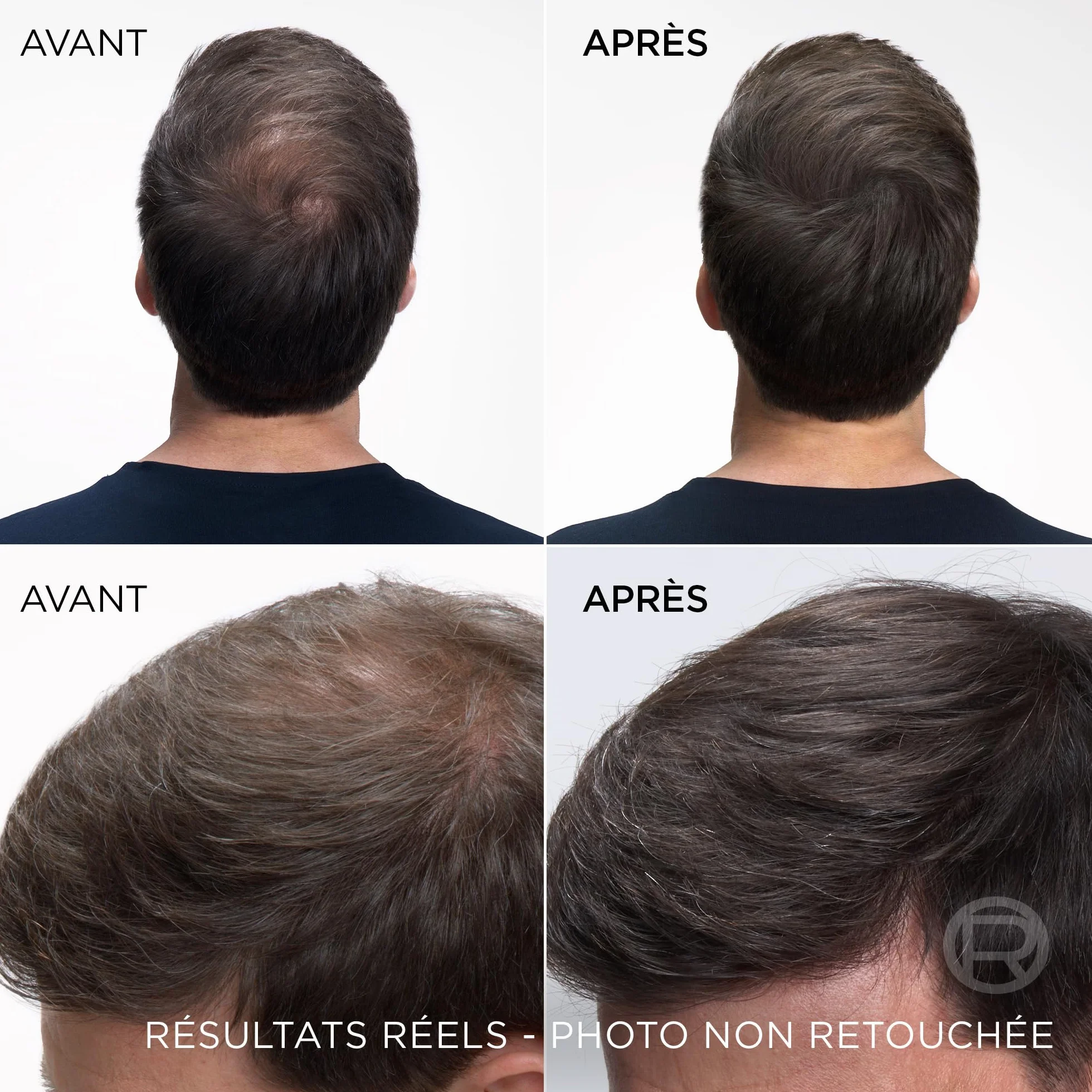 L’ORÉAL PARIS Magic Retouch Spray Instantané Correcteur de Racines & Cheveux Blancs Noir 75ml