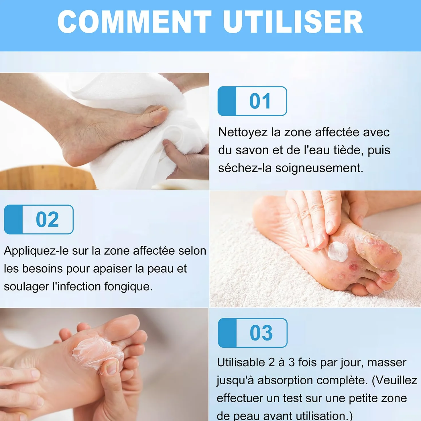 Crème Antifongique 20g - Soin Peau Mycose Pied