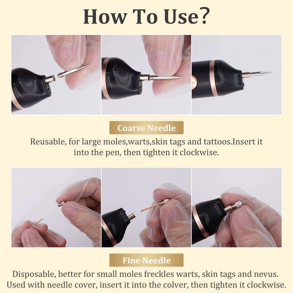 Stylo Laser Plasma à 15 Niveaux Pour L'élimination Des Verrues,Grains De Beauté,Taches,Taches De Rousseur Et Nævus Sur Les Lèvres,Les Mains,Les Yeux,Le Visage,La Tête Et Le Nez, Sûr Et Indolore