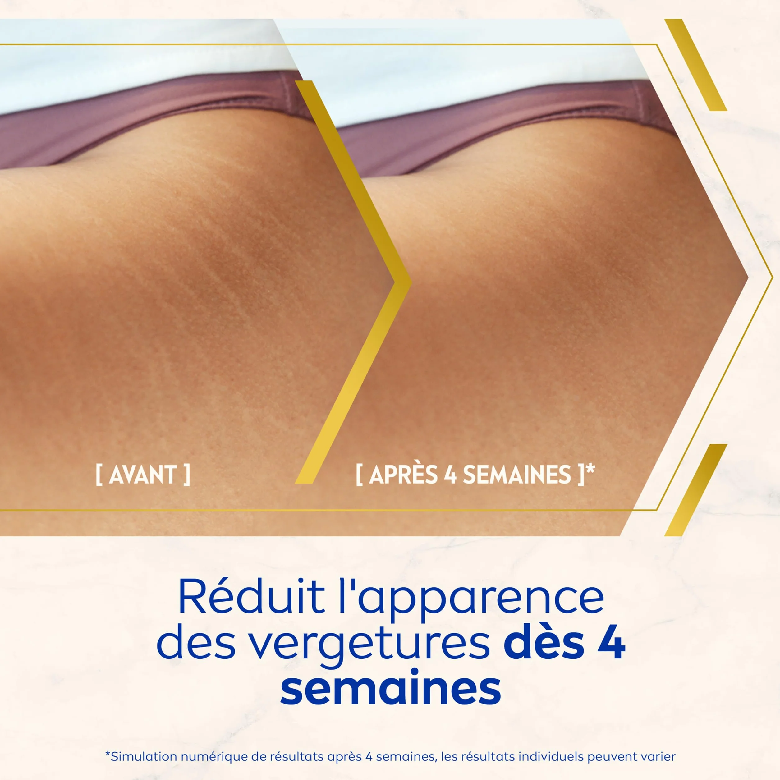 NIVEA Luminous630® Huile-Sérum Corps Anti Vergetures 100 ml soin anti tache hydratation 48h