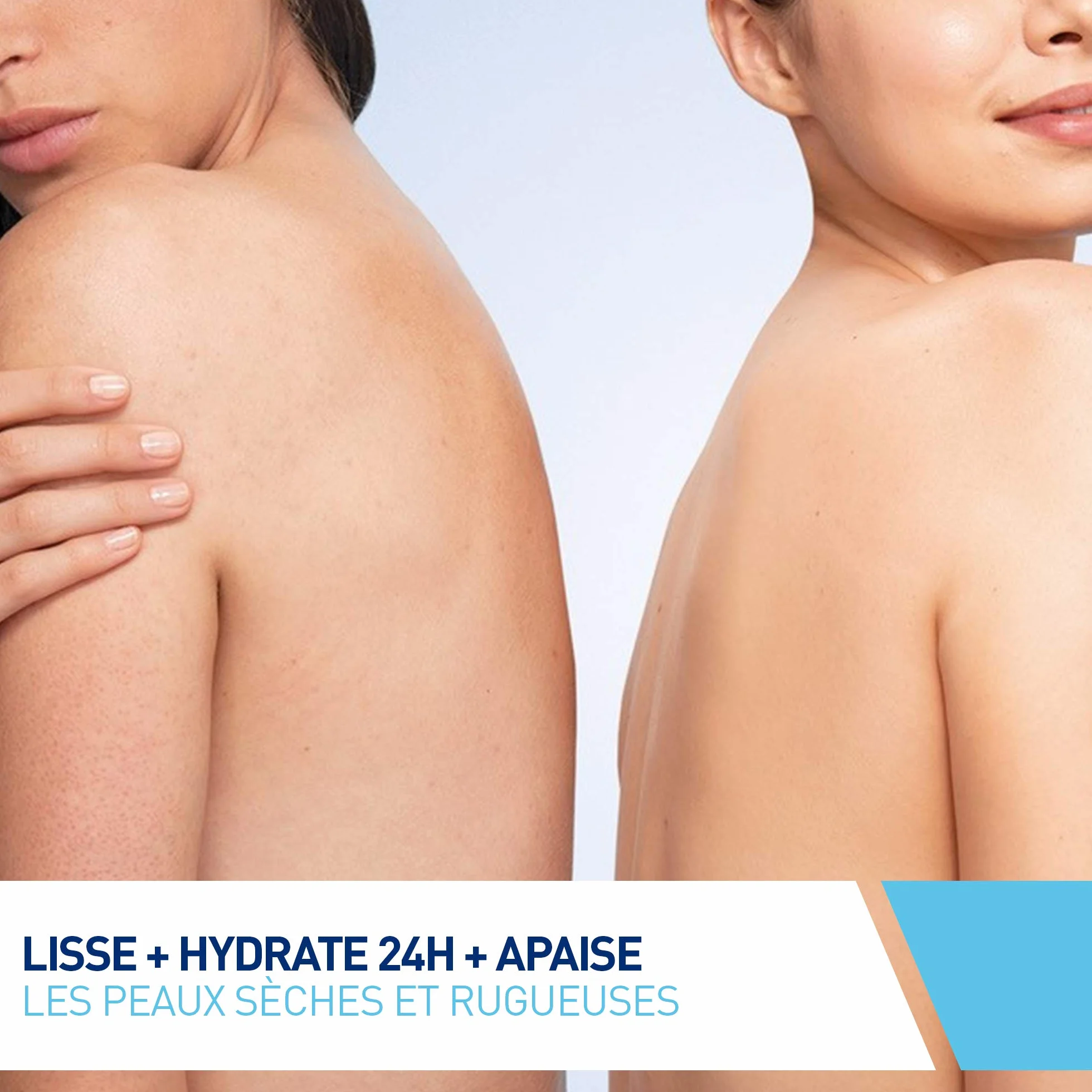 CeraVe - Crème Anti-Rugosités à l’Acide Salicylique, Crème Hydratante Corps, Exfolie, Adoucit et Lisse, Céramides, Acide Hyaluronique, Urée, Peaux Sèches, Rugueuses, Squameuses et Kératose Pilaire