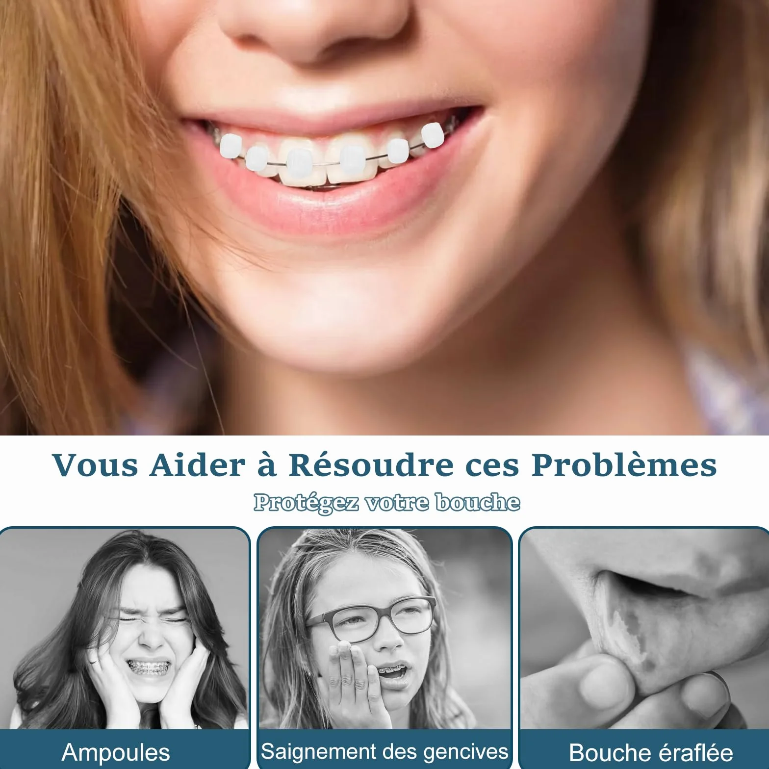 VEGCOO 12 Boîtes Cire Orthodontique Dentaire Soulagement Irritations Soins Orthodontiques