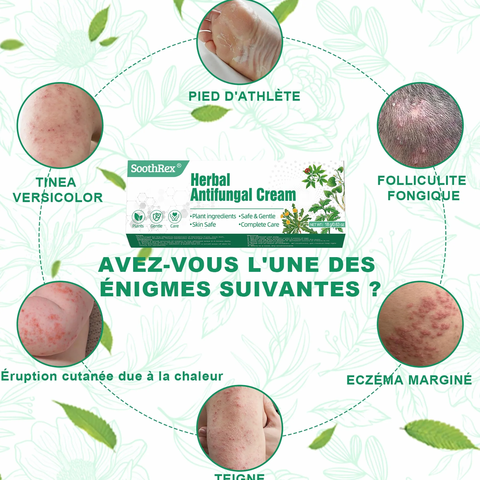 Crème antifongique à base de plantes pour pied d'athlète, teigne, eczéma marginé de Hebra