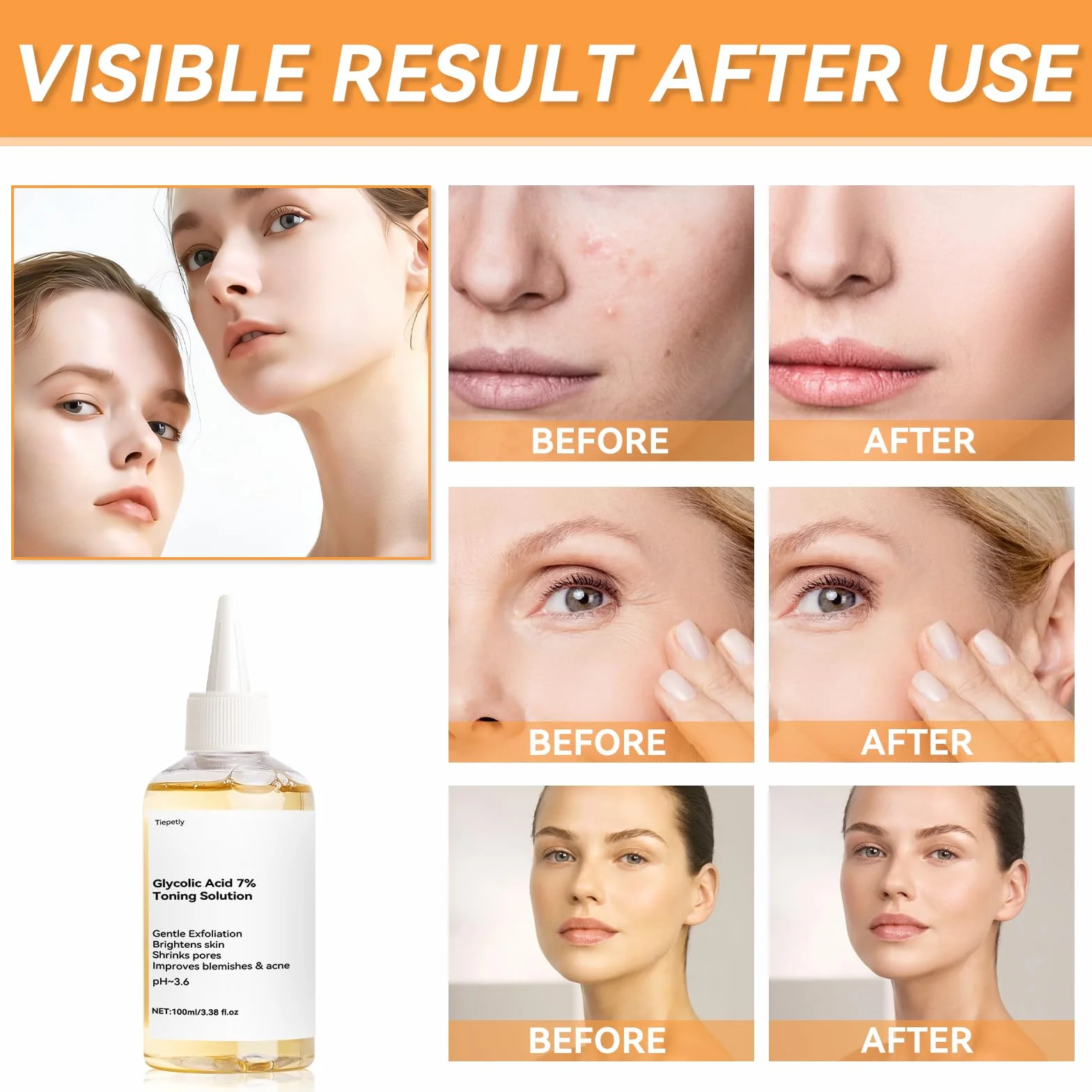 Acide Glycolique 7% Toning Solution Hydratant Imperfections Acné