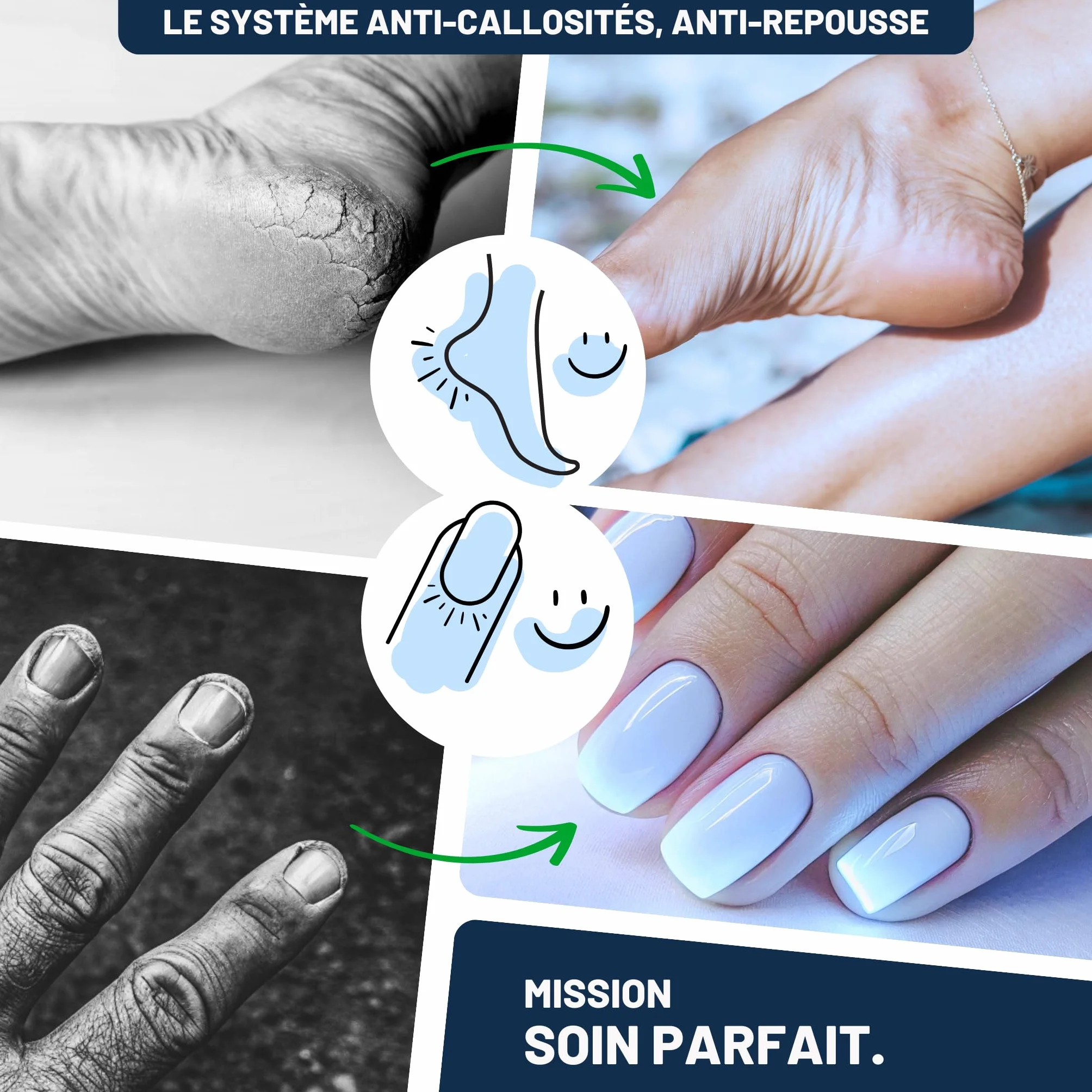 Mr. Fuss Solution Anti Callosités Dissolvant Pour les Cornes Lotion 250ml Set de Pédicure