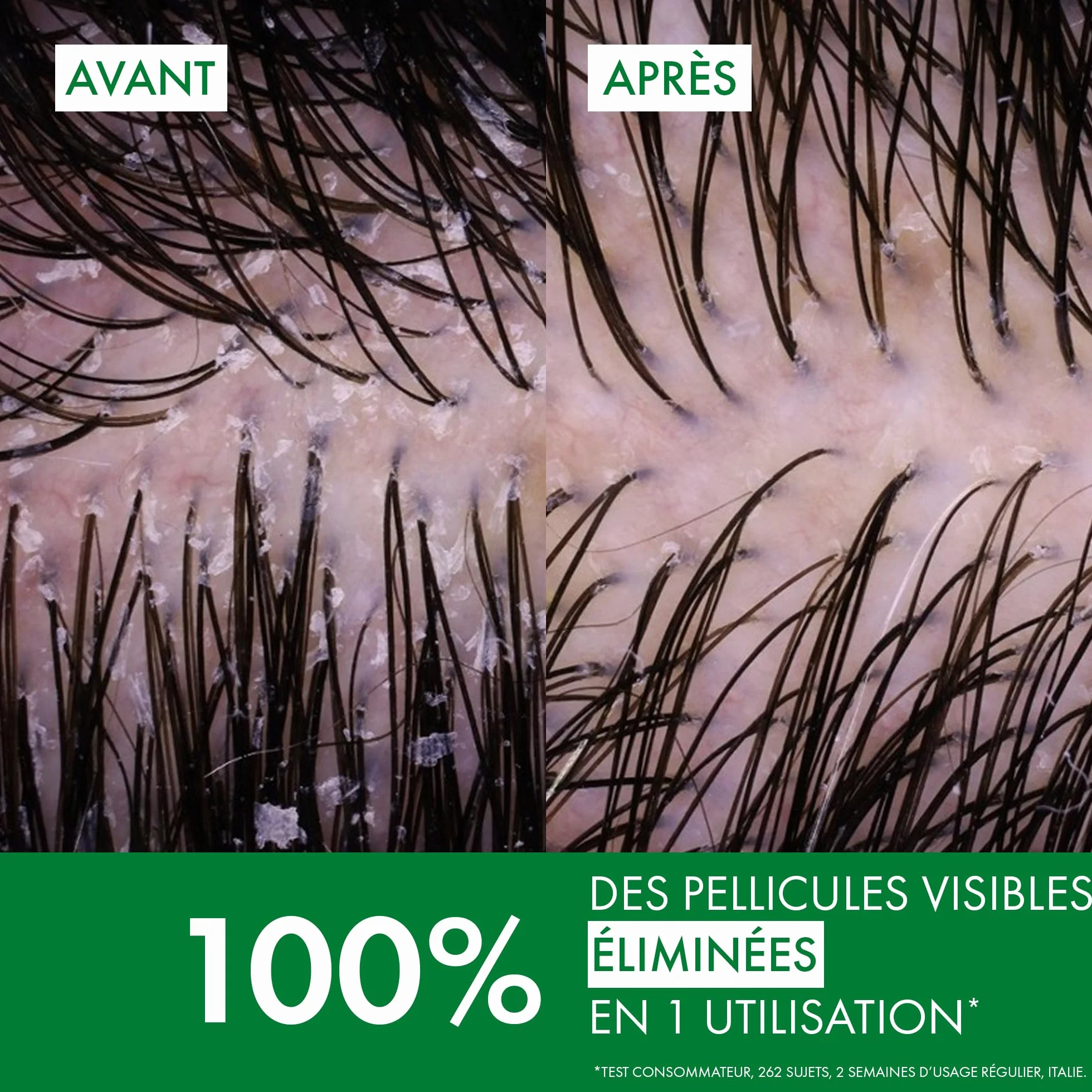 VICHY DERCOS Shampooing Anti-Pelliculaire DS Cheveux Normaux à Gras 390 ml