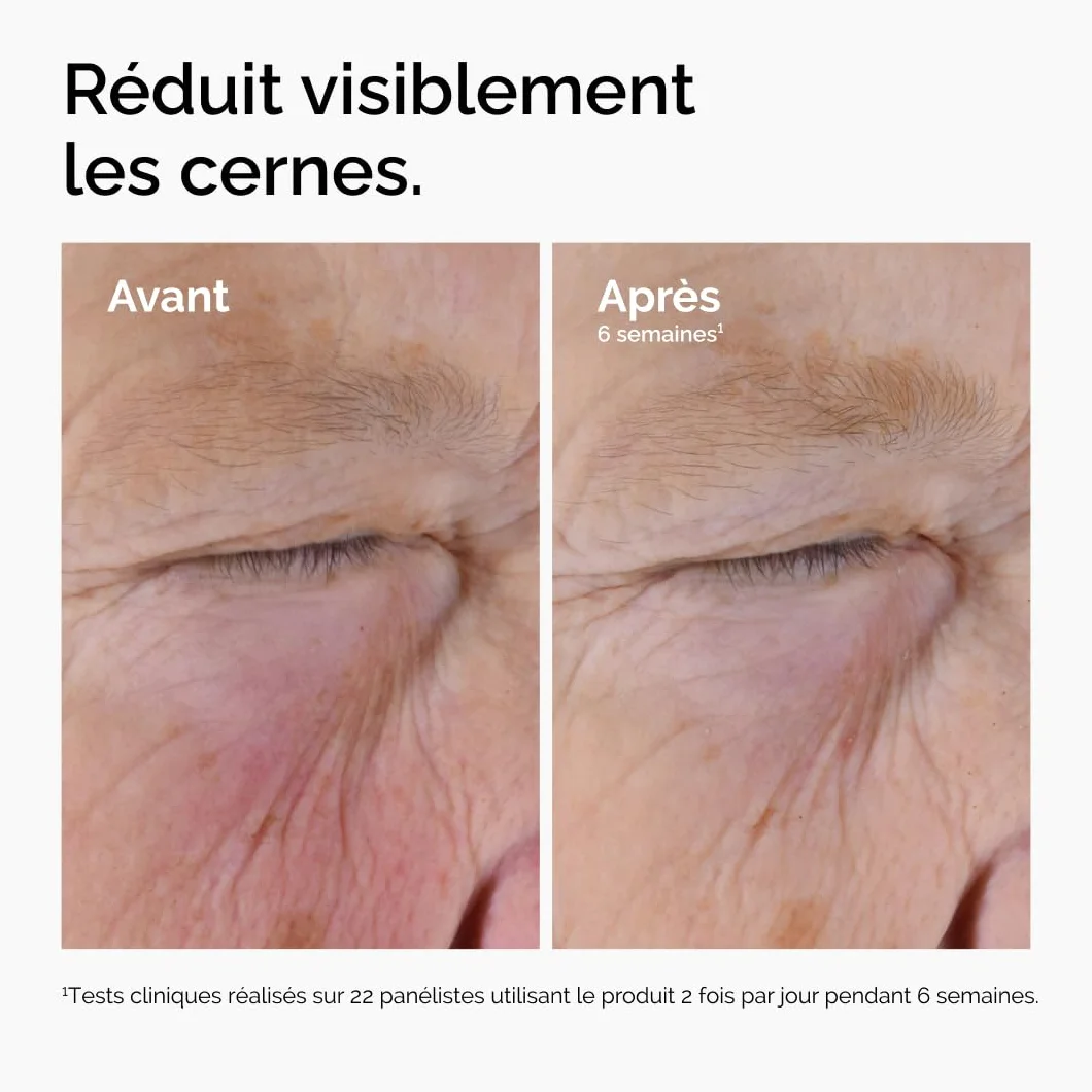 The Ordinary Solution à la Caféine 5% + EGCG Sérum anti-cernes 30 ml