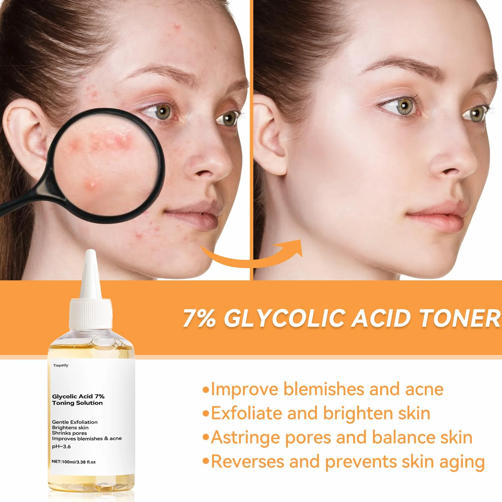 Acide Glycolique 7% Toning Solution Hydratant Imperfections Acné