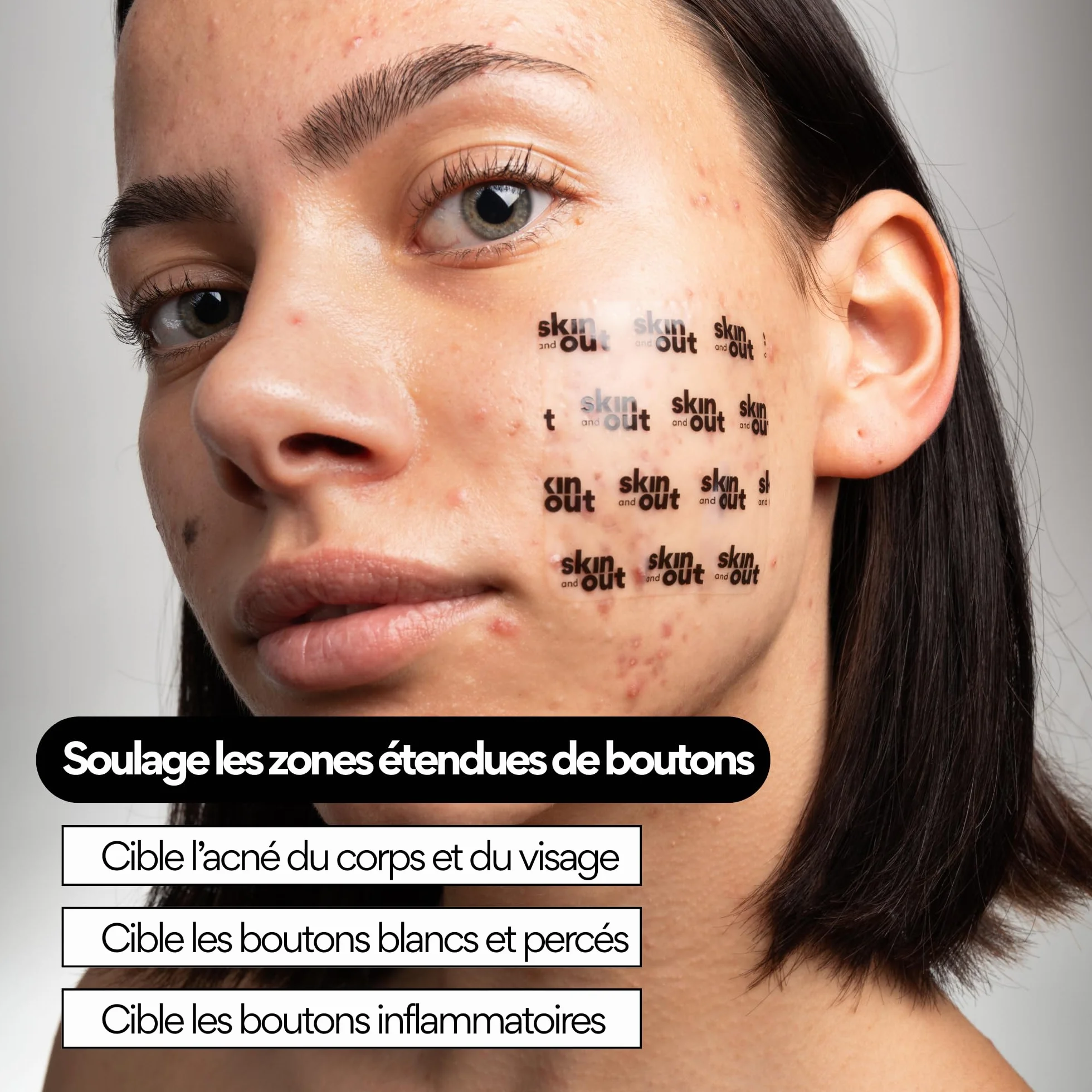 Patchs Boutons XL Hydrocolloïdes Visage Corps Grandes Zones Réduit Boutons Inflammation Vitamine C Acide Salicylique Vegan