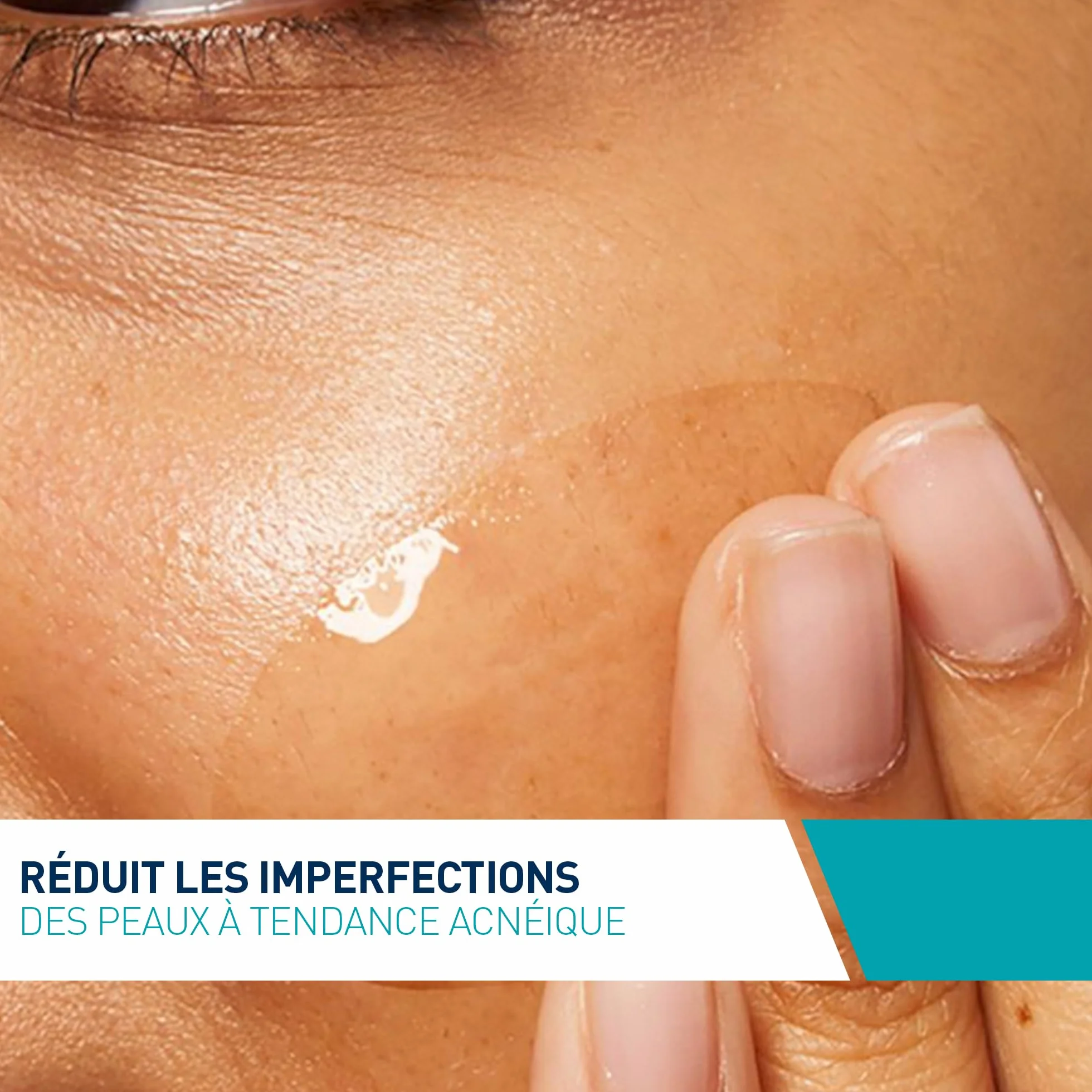 CeraVe Soin Concentré Anti-Imperfection AHA-BHA Acide Hyaluronique 3 Céramides Peau Acnéique 40 ml