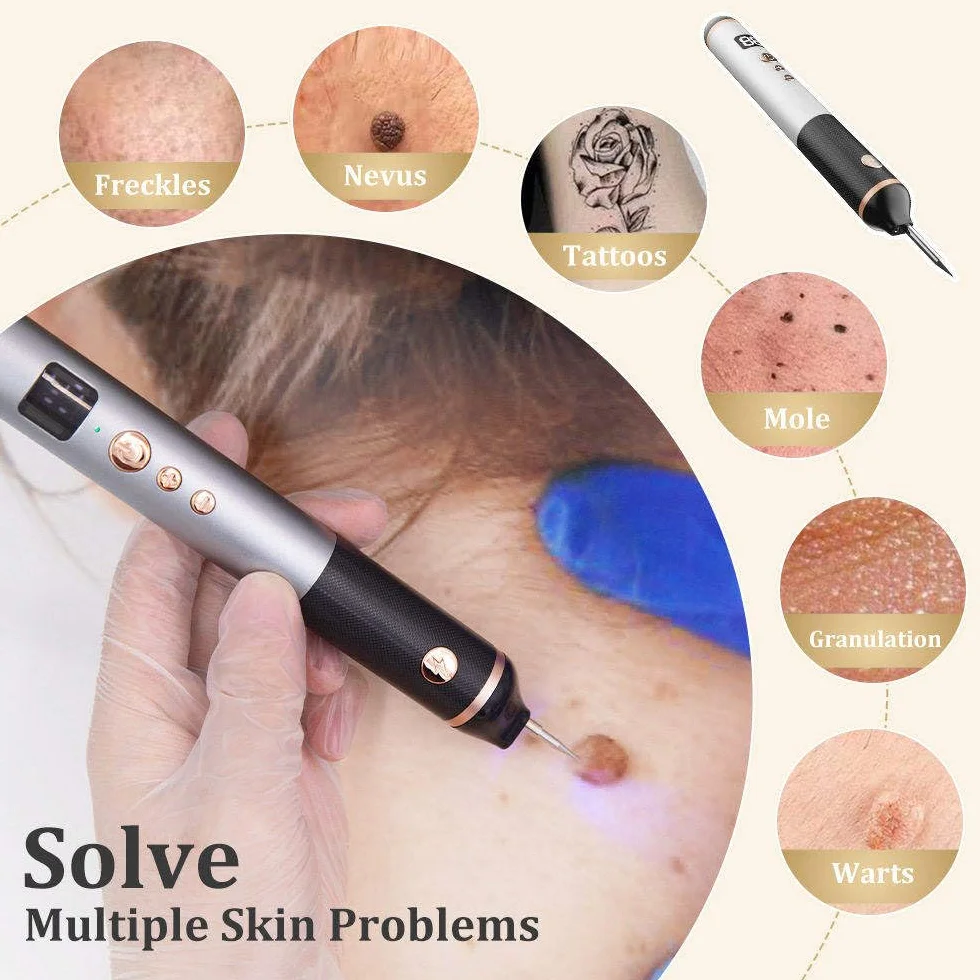 Stylo Laser Plasma à 15 Niveaux Pour L'élimination Des Verrues,Grains De Beauté,Taches,Taches De Rousseur Et Nævus Sur Les Lèvres,Les Mains,Les Yeux,Le Visage,La Tête Et Le Nez, Sûr Et Indolore