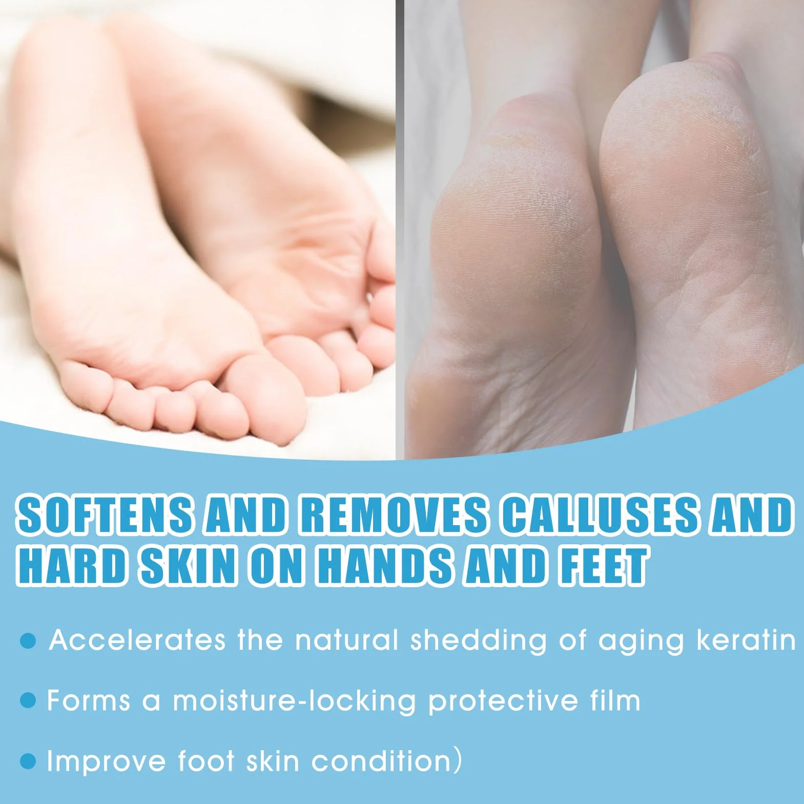 Lotion Anti Callosités Pieds 250 ml Soin Callus Remover Nano-Verre