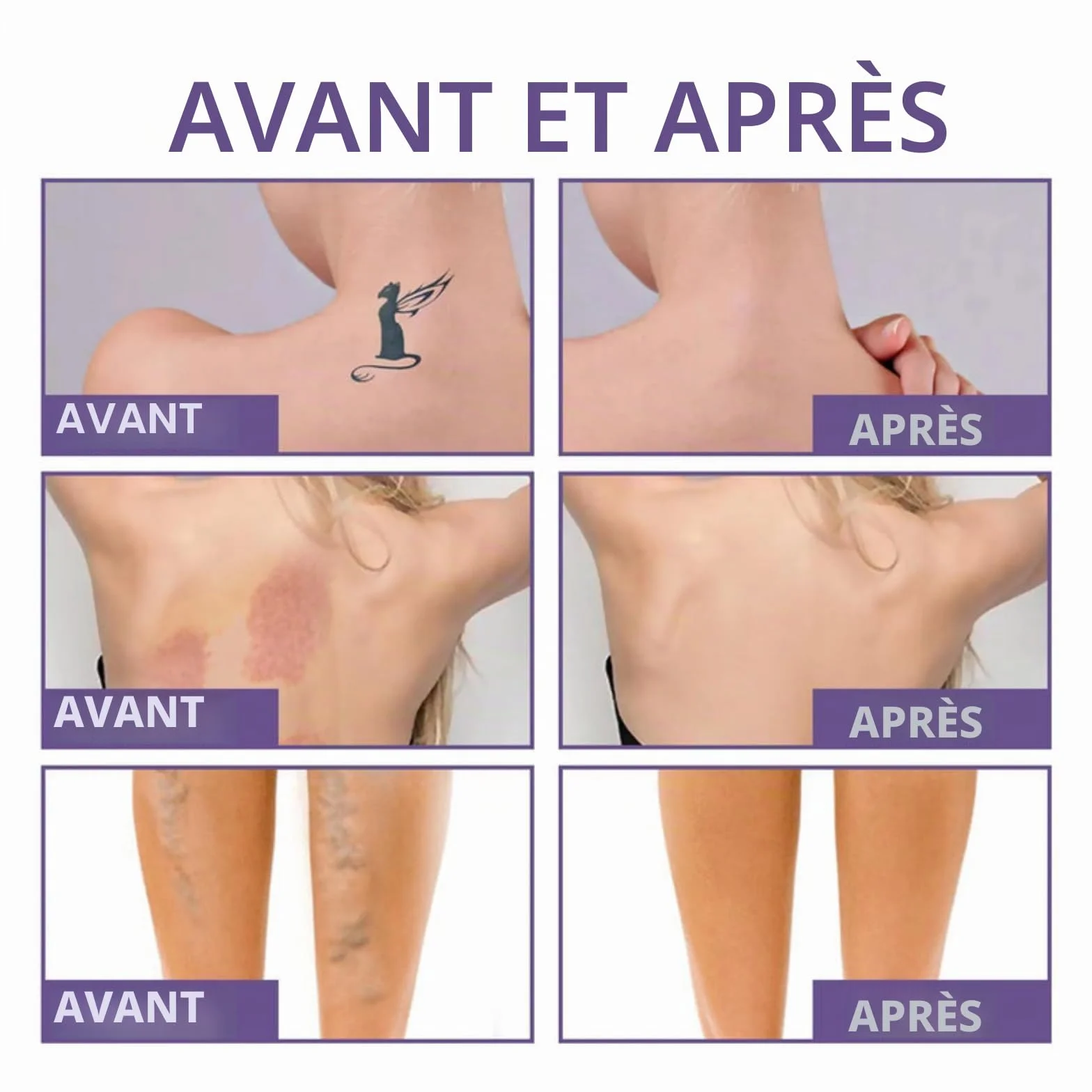 MIRACLEDE PARIS Body Perfector,Correcteur Corps Entier Etanche,Anti-Transfert,Camoufle Veines,Cicatrices et Tatouages,Texture Légère pour Peau Naturelle