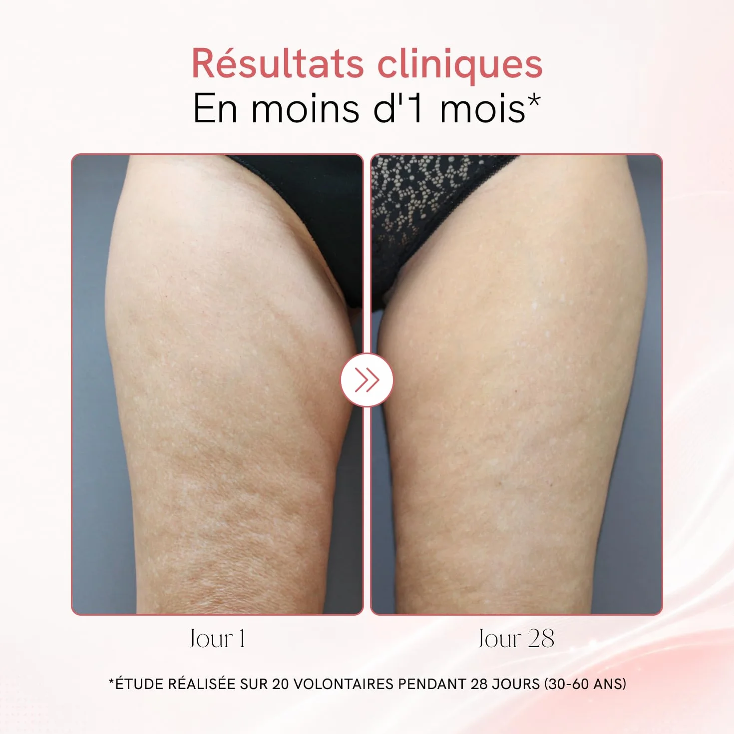 MASDERM | Gel-Crème Corps Ultrasons Raffermissant Radiofréquence | 1000 ml | Professionnel | Femme | Cavitation | Hydratant | Lumière LED | Abdominale, Ceinture et Ventre | Electrostimulateur