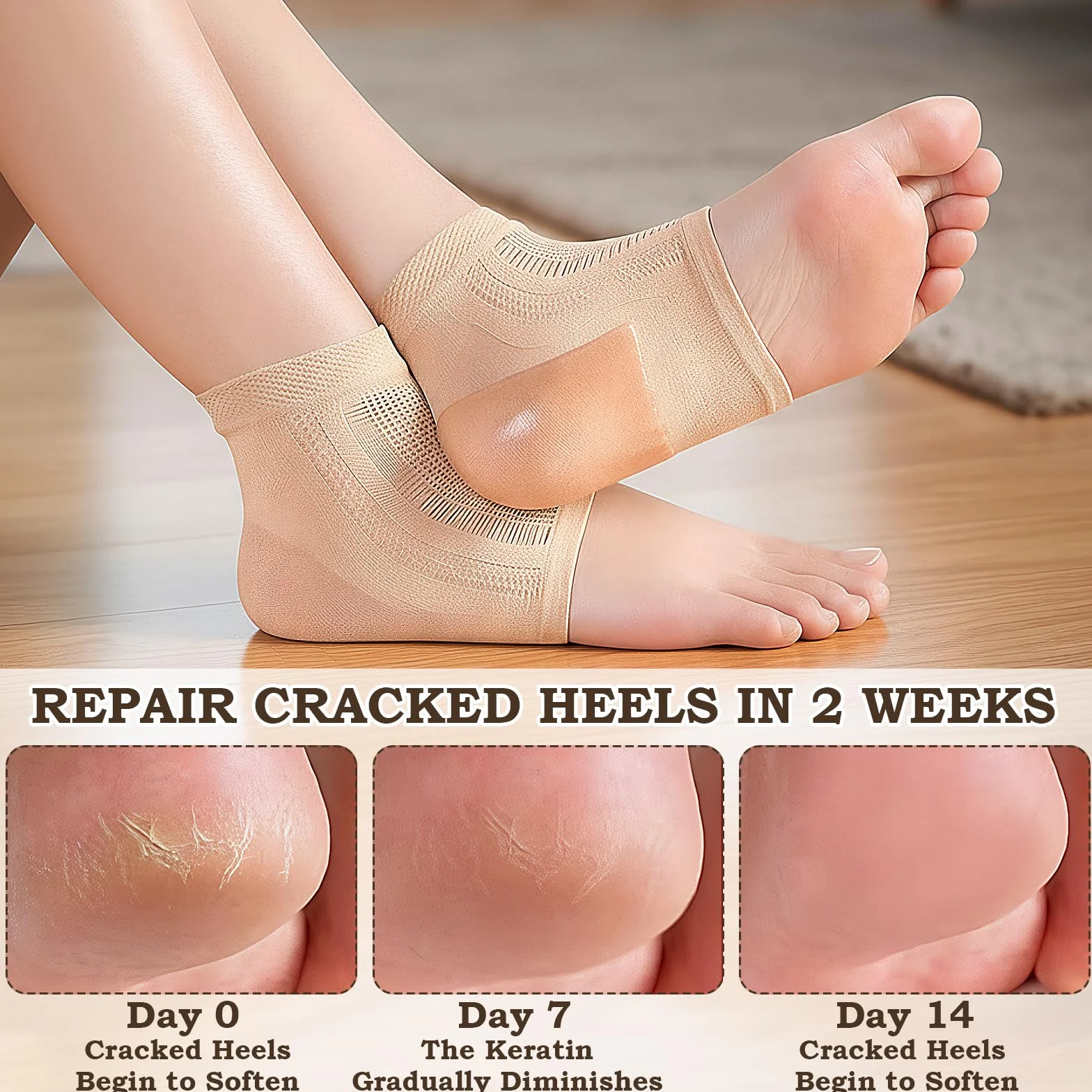 Chaussettes à Talons en Gel, Chaussettes en Silicone Ventilées, Chaussettes Hydratantes pour Femmes et Hommes, Traitement des Talons Secs