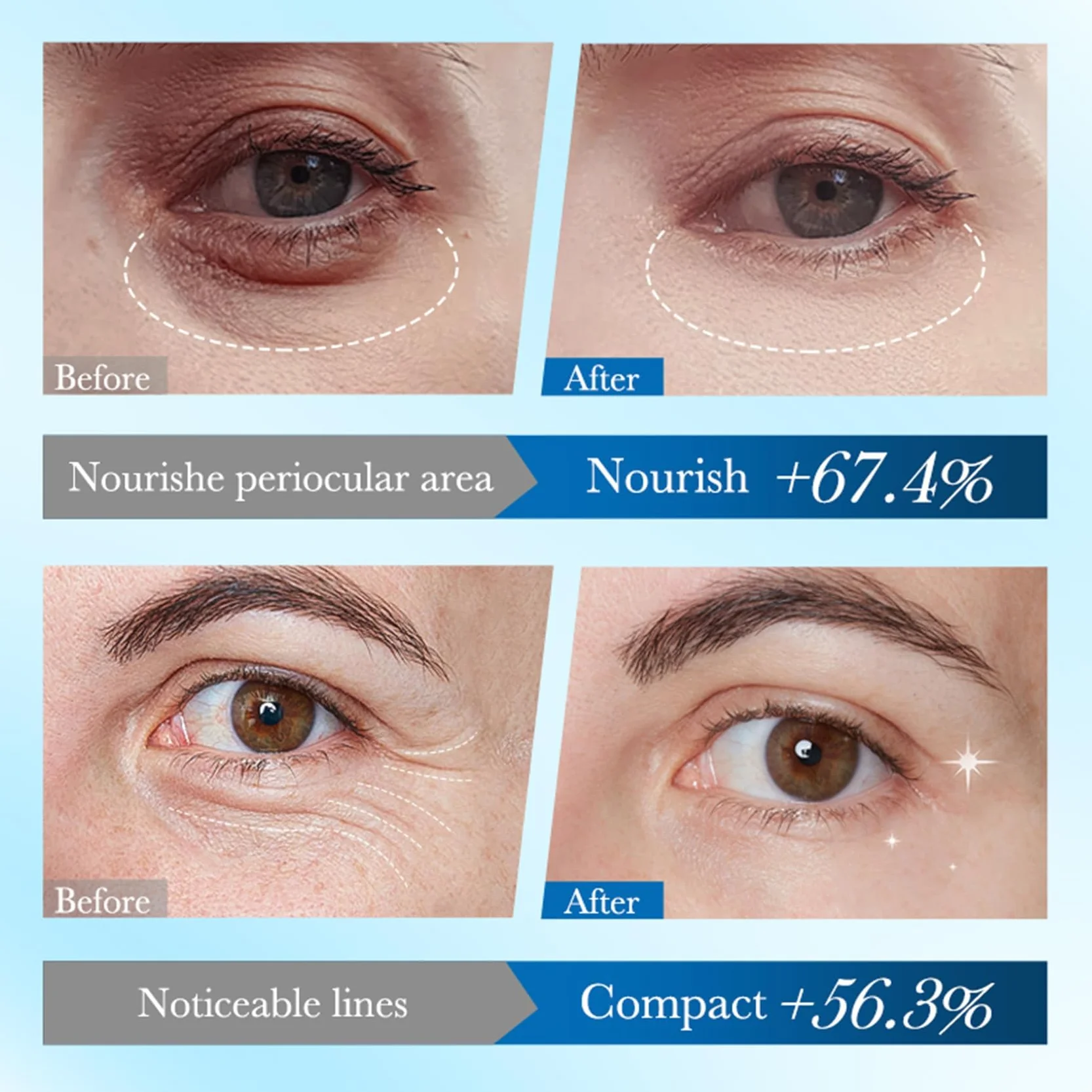 Patch Yeux Collagene Acide Hyaluronique 60 Pcs Anti Cernes Anti-Rides Masque Hydratant Contour des Yeux