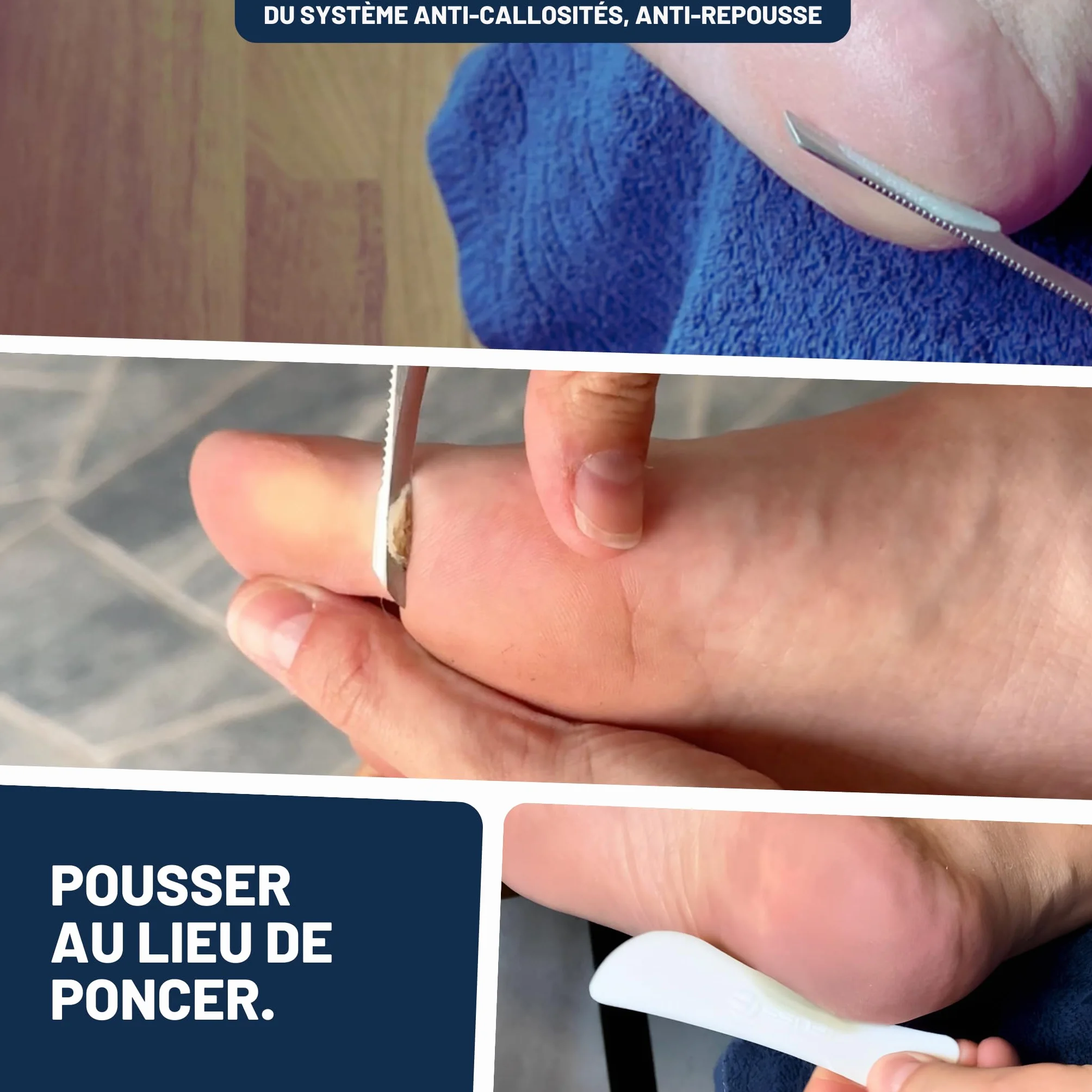 Mr. Fuss No. 1 Solution anti-callosités