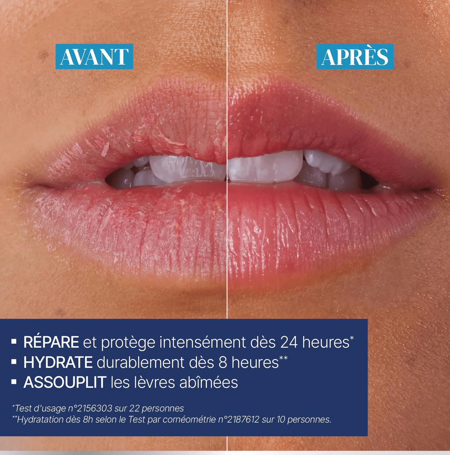 Urgo Baume Lèvres abimées ultra-riche 10 ml beurre de karité miel purifié