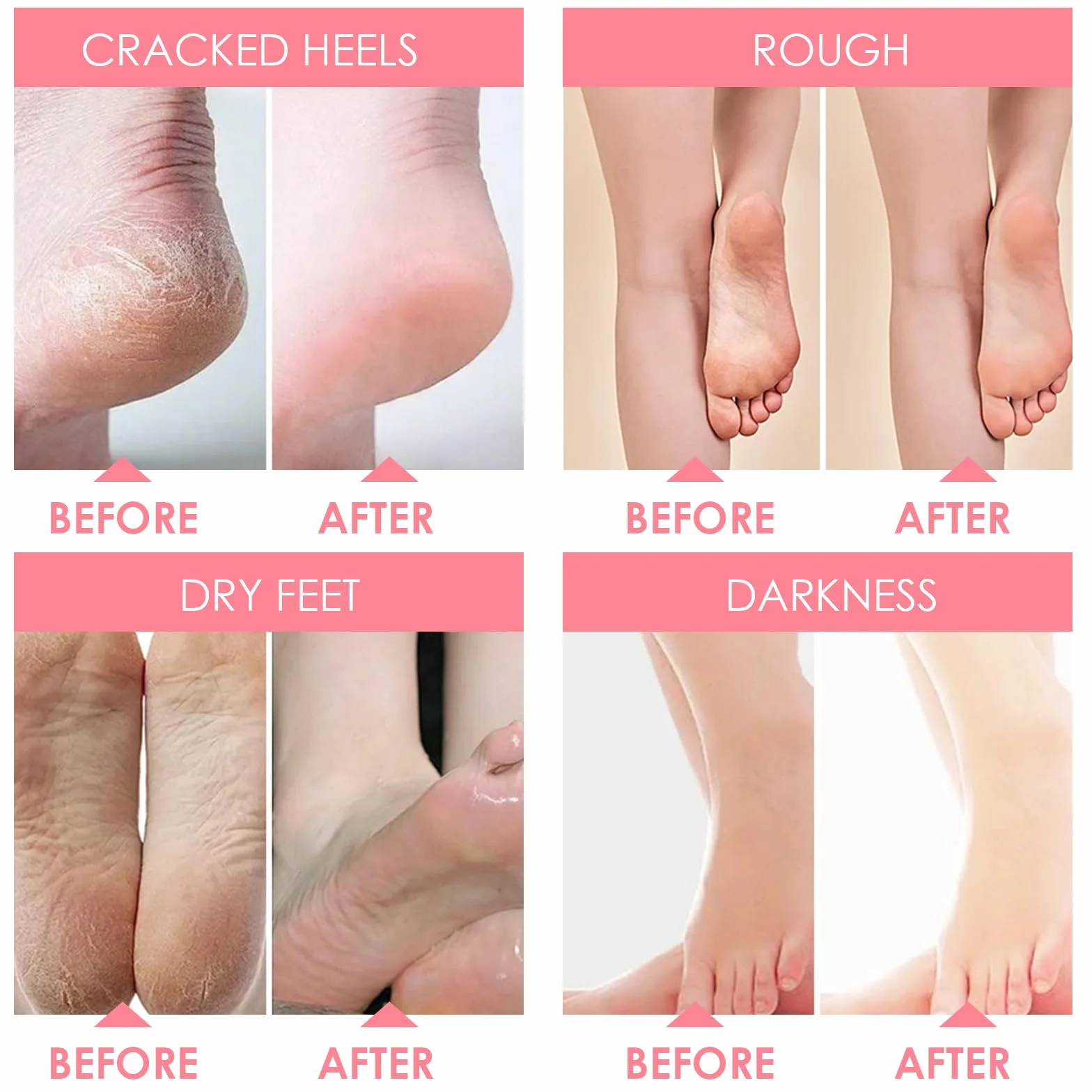 Masque Pieds Peeling Exfoliant pour Femmes & Hommes, Fraise Pêche
