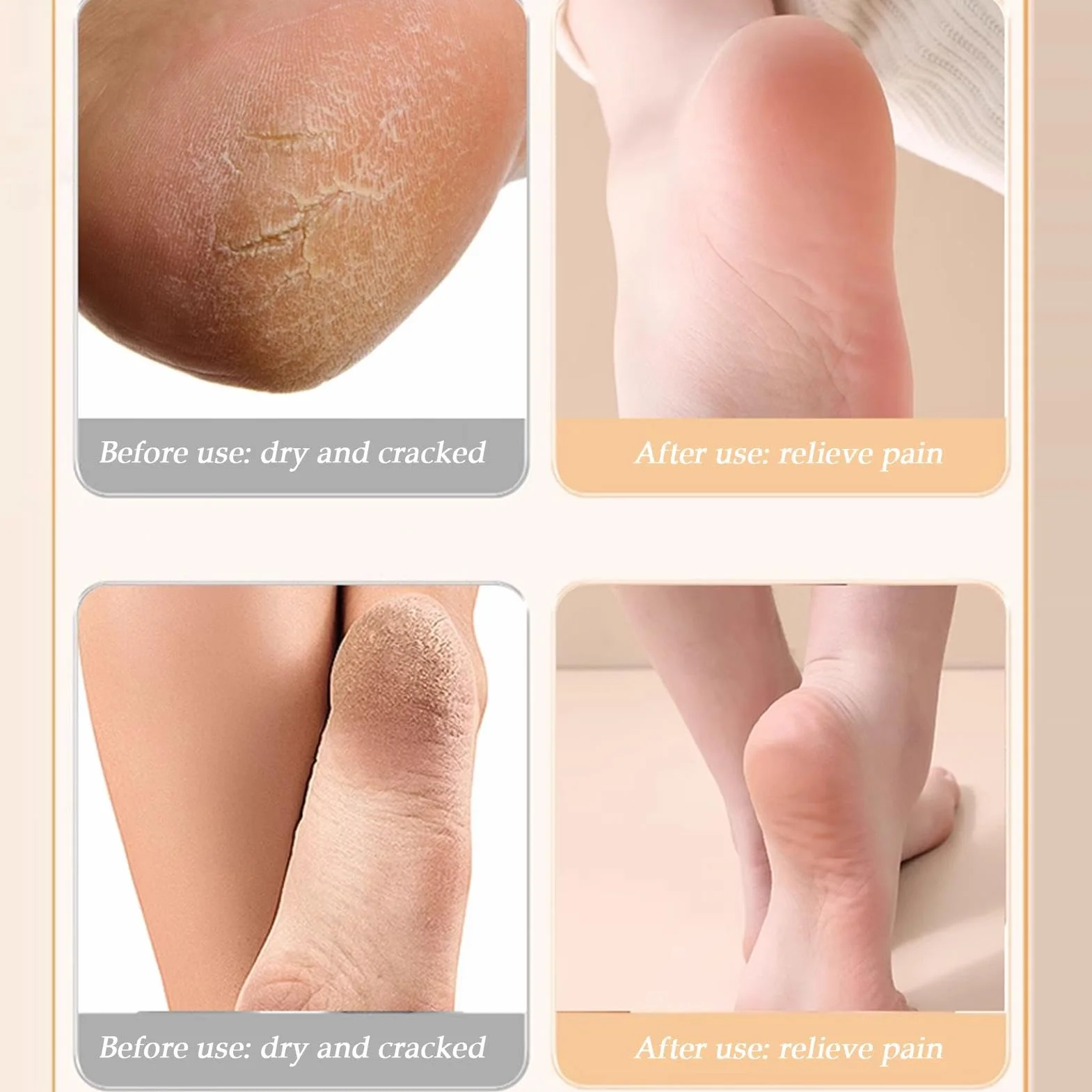 Breathable Silicone Foot Socks for Dry Cracked Feet, Soft U Shape Spa Care, Lightweight