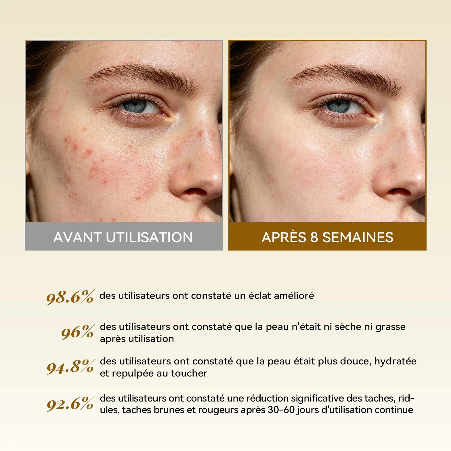 ANAiRUi Tampons Nettoyants Exfoliants Acide Kojique Curcuma Niacinamide Acide Salicylique Traitement Facial Nettoyant Profondeur Réduction Acné Sébum 50 Pièces