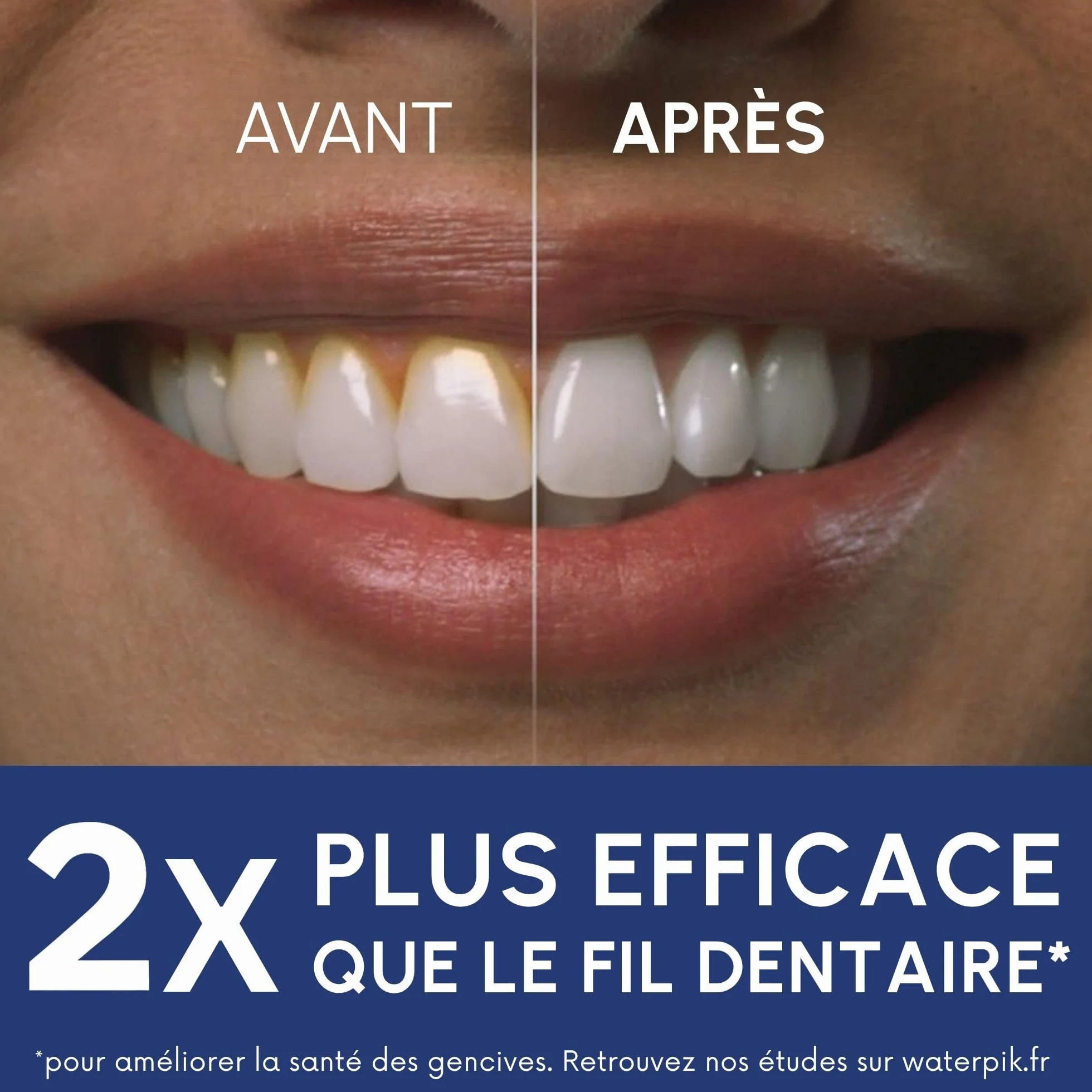 Waterpik Hydropulseur Ultra professionnel Jet dentaire 6 embouts 10 niveaux pression Blanc WF-660EU