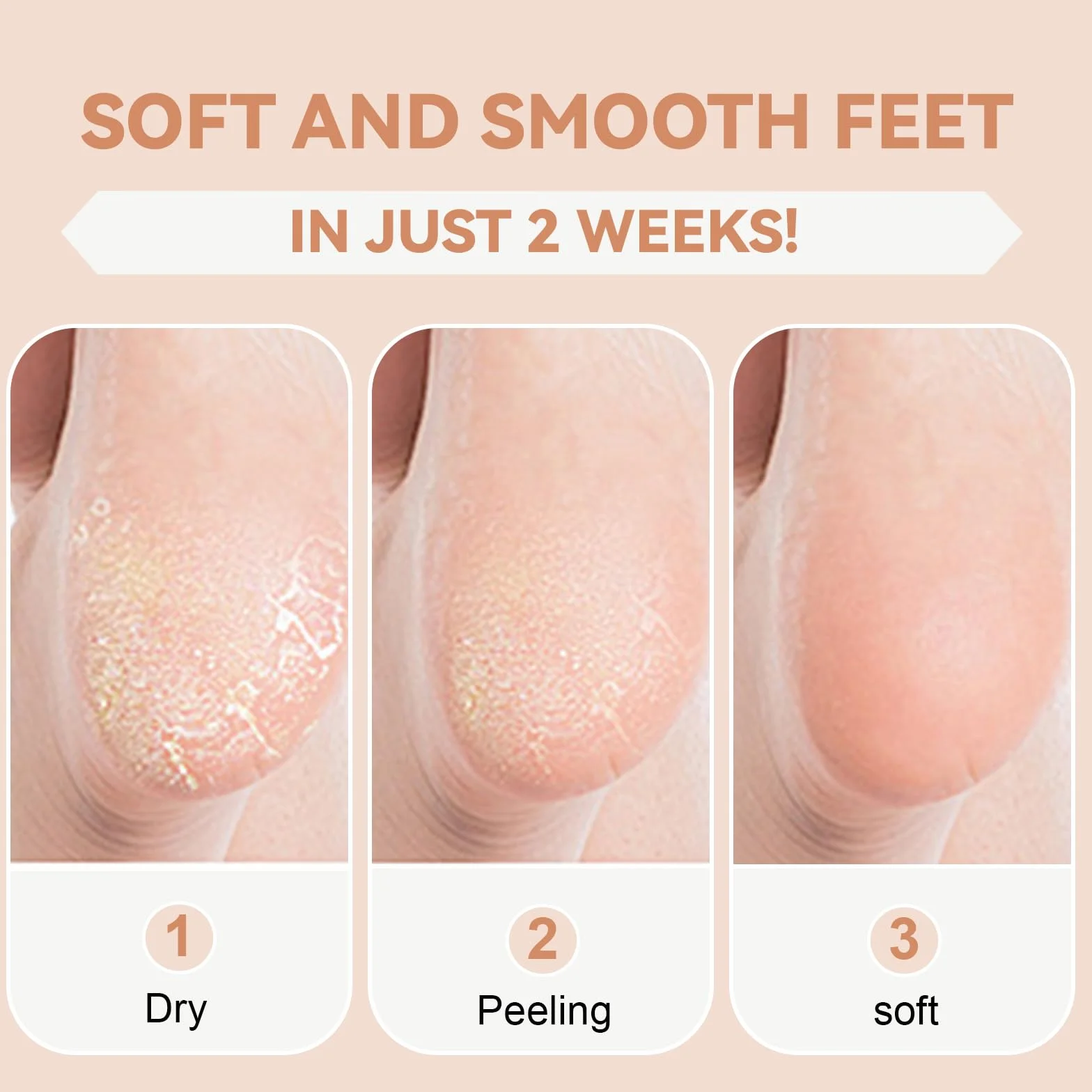 Chaussettes Hydratantes Pieds Secs Antidérapant Silicone Crevassés Peau Rugueuse Spa Beige