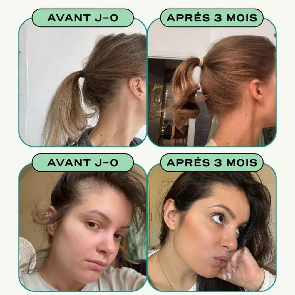 GROW Complément Antichute Cheveux Femme Stimule Repousse Rééquilibre Cuir Chevelu Renforce Ongles