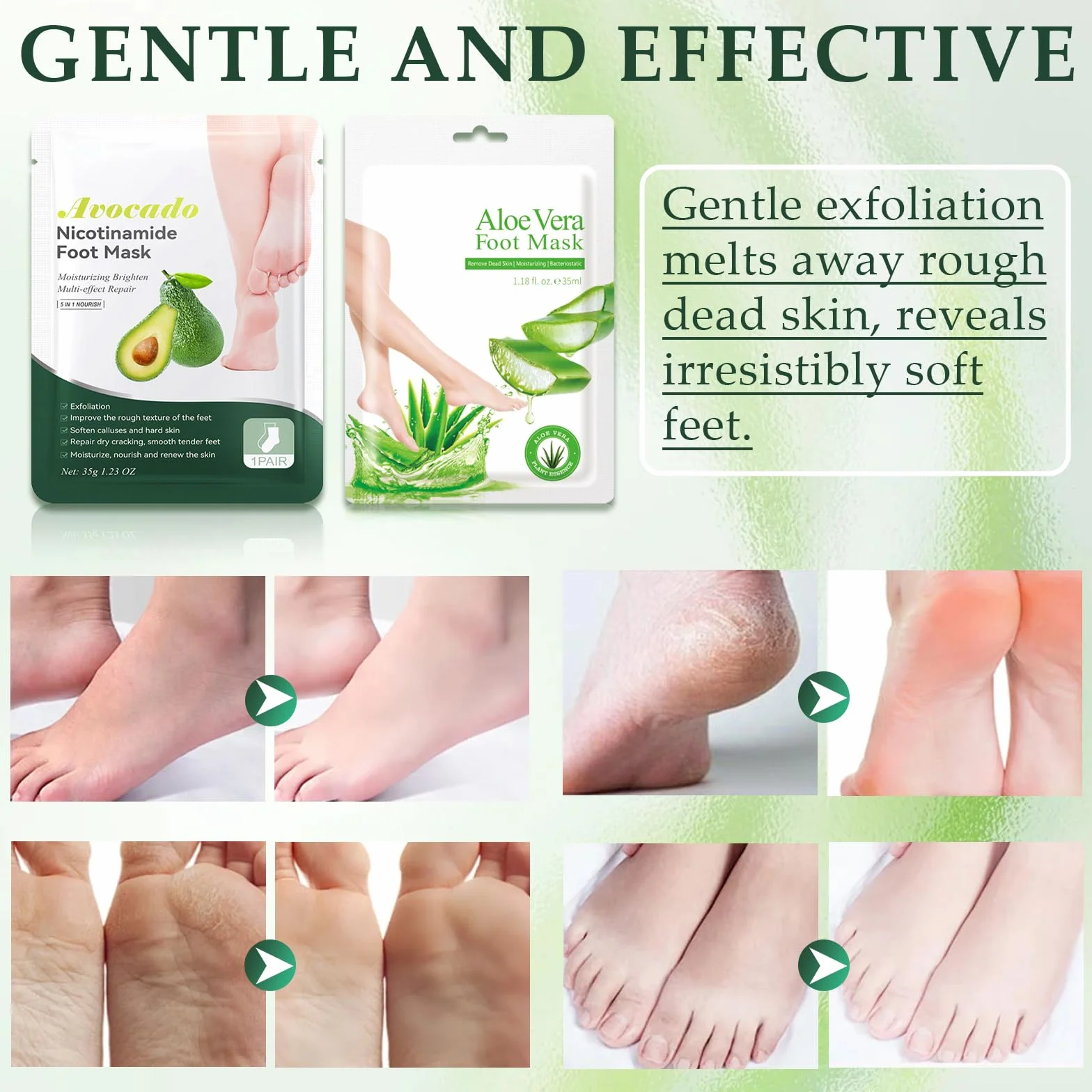 Masque Hydratant Pieds Aloe Vera Avocat, Soin Nourrissant Exfoliant Callosités, Pieds Secs Abîmés Talons Lisses