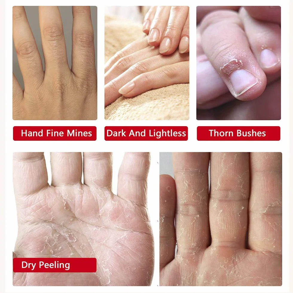 Gants Hydratants pour Mains avec Collagène, Sérum et Vitamines, 5 Paires, Lavande, Blanchissant Anti-âge
